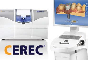 Can You Benefit from CEREC?